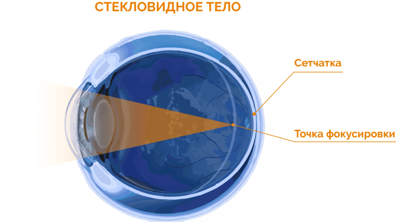 Как я сделал лазерную коррекцию зрения, сколько это стоило в 2023 году, и где было прям больно